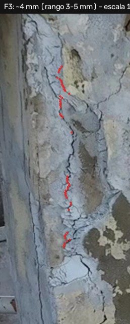 Fisura F3 vertical en la columna